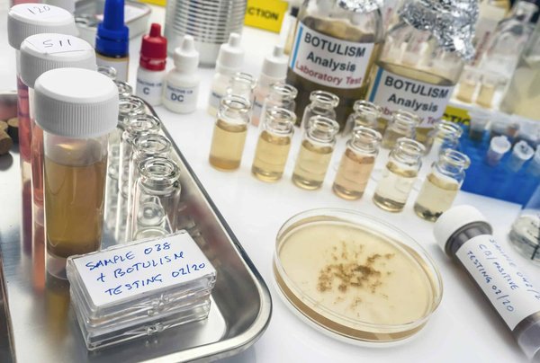 What Is the Role of Environmental Toxins in the Increasing Prevalence of Autoimmune Diseases?